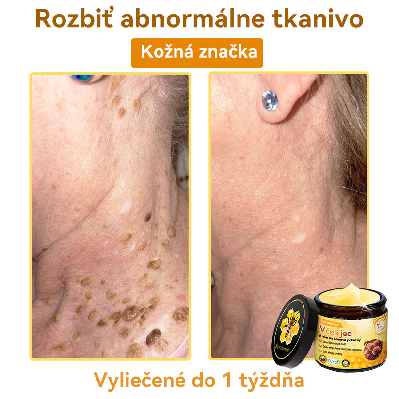 [💯 Bez bolesti-bez vedľajších účinkov] 𝐃𝐨𝐫𝐦𝐨𝐫𝐧𝐚®💥💥𝐕č𝐞𝐥í 𝐣𝐞𝐝 𝐊𝐫é𝐦 𝐧𝐚 𝐨𝐛𝐧𝐨𝐯𝐮 𝐩𝐨𝐤𝐨ž𝐤𝐲- POSLEDNÝ DEŇ 70% VYPNUTIE