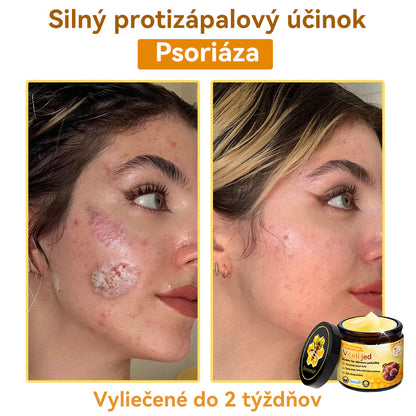 [💯 Bez bolesti-bez vedľajších účinkov] 𝐃𝐨𝐫𝐦𝐨𝐫𝐧𝐚®💥💥𝐕č𝐞𝐥í 𝐣𝐞𝐝 𝐊𝐫é𝐦 𝐧𝐚 𝐨𝐛𝐧𝐨𝐯𝐮 𝐩𝐨𝐤𝐨ž𝐤𝐲- POSLEDNÝ DEŇ 70% VYPNUTIE