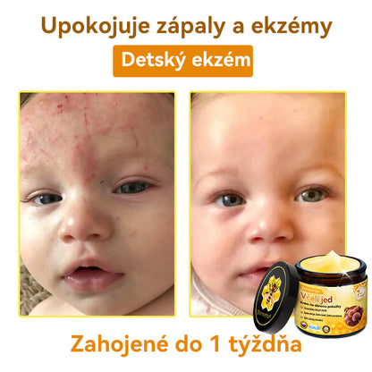 [💯 Bez bolesti-bez vedľajších účinkov] 𝐃𝐨𝐫𝐦𝐨𝐫𝐧𝐚®💥💥𝐕č𝐞𝐥í 𝐣𝐞𝐝 𝐊𝐫é𝐦 𝐧𝐚 𝐨𝐛𝐧𝐨𝐯𝐮 𝐩𝐨𝐤𝐨ž𝐤𝐲- POSLEDNÝ DEŇ 70% VYPNUTIE