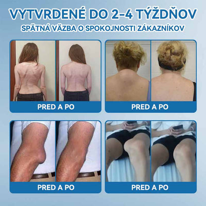 𝐎𝐟𝐢𝐜𝐢á𝐥𝐧𝐲 𝐨𝐛𝐜𝐡𝐨𝐝 | 👩‍⚕️🎁𝗣𝗶𝗰𝗱𝗼® 𝗕𝗣𝗖-𝟭𝟱𝟳 𝗞𝗿é𝗺 𝗻𝗮 𝗵𝗼𝗷𝗲𝗻𝗶𝗲 𝗸ĺ𝗯𝗼𝘃🦴Lieči artritídu, neuropatiu, reumu, športové zranenia a ďalšie ochorenia.👩‍⚕️