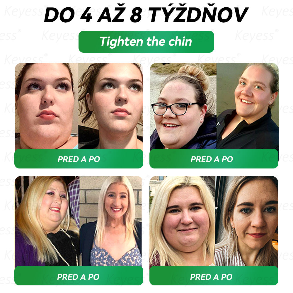 🥒🥒Oficiálny obchod | 𝑲𝒆𝒚𝒆𝒔𝒔®𝑮𝑳𝑷-1 9-𝒊𝒏-1 𝑍𝑑𝑟𝑎𝑣𝑖𝑒 𝑃𝑒𝑟𝑜𝑟á𝑙𝑛𝑦 𝐾𝑣𝑎𝑝𝑎𝑙𝑖𝑛𝑎— 𝑉𝑧𝑜𝑟𝑒𝑐 𝑛𝑎 𝑝𝑜𝑑𝑝𝑜𝑟𝑢 𝑖𝑚𝑢𝑛𝑖𝑡𝑦 𝑎 𝑑𝑒𝑡𝑜𝑥𝑖𝑘á𝑐𝑖𝑒