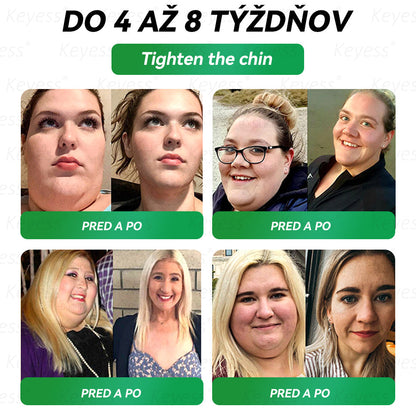 🥒🥒Oficiálny obchod | 𝑲𝒆𝒚𝒆𝒔𝒔®𝑮𝑳𝑷-1 9-𝒊𝒏-1 𝑍𝑑𝑟𝑎𝑣𝑖𝑒 𝑃𝑒𝑟𝑜𝑟á𝑙𝑛𝑦 𝐾𝑣𝑎𝑝𝑎𝑙𝑖𝑛𝑎— 𝑉𝑧𝑜𝑟𝑒𝑐 𝑛𝑎 𝑝𝑜𝑑𝑝𝑜𝑟𝑢 𝑖𝑚𝑢𝑛𝑖𝑡𝑦 𝑎 𝑑𝑒𝑡𝑜𝑥𝑖𝑘á𝑐𝑖𝑒