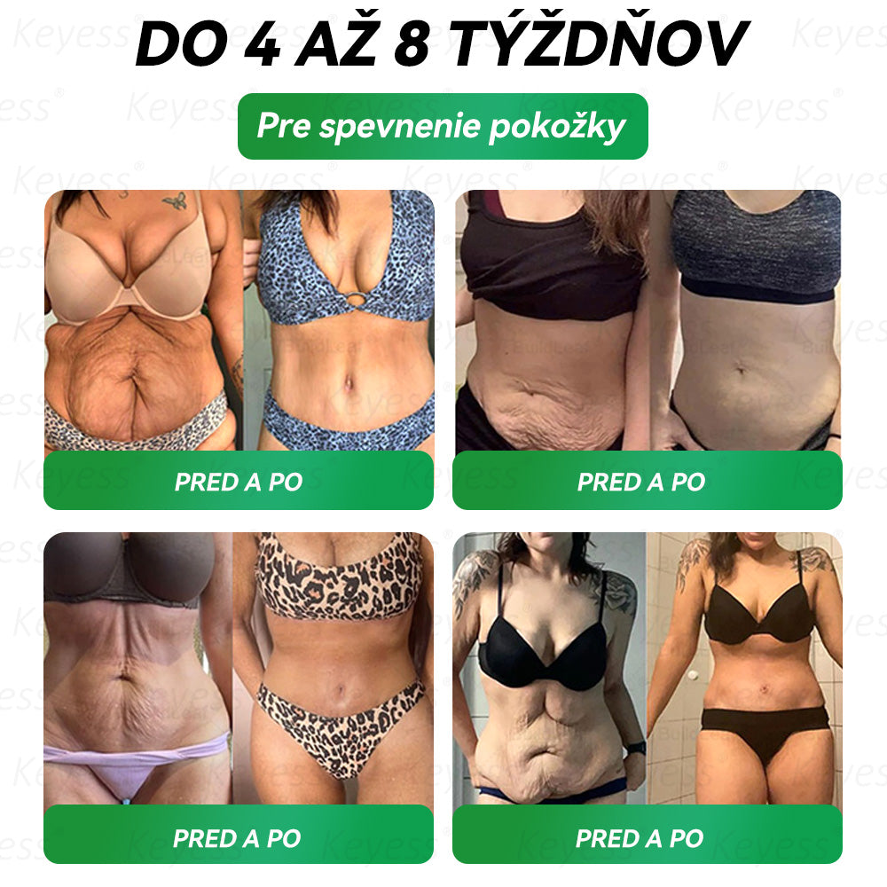 🥒🥒Oficiálny obchod | 𝑲𝒆𝒚𝒆𝒔𝒔®𝑮𝑳𝑷-1 9-𝒊𝒏-1 𝑍𝑑𝑟𝑎𝑣𝑖𝑒 𝑃𝑒𝑟𝑜𝑟á𝑙𝑛𝑦 𝐾𝑣𝑎𝑝𝑎𝑙𝑖𝑛𝑎— 𝑉𝑧𝑜𝑟𝑒𝑐 𝑛𝑎 𝑝𝑜𝑑𝑝𝑜𝑟𝑢 𝑖𝑚𝑢𝑛𝑖𝑡𝑦 𝑎 𝑑𝑒𝑡𝑜𝑥𝑖𝑘á𝑐𝑖𝑒