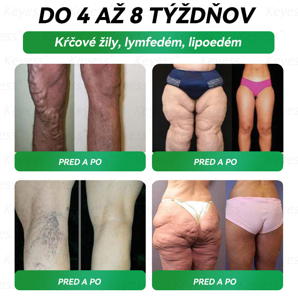 🥒🥒Oficiálny obchod | 𝑲𝒆𝒚𝒆𝒔𝒔®𝑮𝑳𝑷-1 9-𝒊𝒏-1 𝑍𝑑𝑟𝑎𝑣𝑖𝑒 𝑃𝑒𝑟𝑜𝑟á𝑙𝑛𝑦 𝐾𝑣𝑎𝑝𝑎𝑙𝑖𝑛𝑎— 𝑉𝑧𝑜𝑟𝑒𝑐 𝑛𝑎 𝑝𝑜𝑑𝑝𝑜𝑟𝑢 𝑖𝑚𝑢𝑛𝑖𝑡𝑦 𝑎 𝑑𝑒𝑡𝑜𝑥𝑖𝑘á𝑐𝑖𝑒