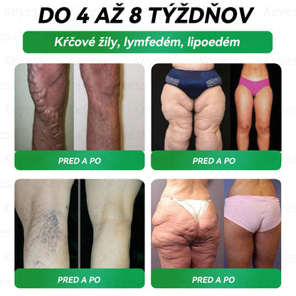 🥒🥒Oficiálny obchod | 𝑲𝒆𝒚𝒆𝒔𝒔®𝑮𝑳𝑷-1 9-𝒊𝒏-1 𝑍𝑑𝑟𝑎𝑣𝑖𝑒 𝑃𝑒𝑟𝑜𝑟á𝑙𝑛𝑦 𝐾𝑣𝑎𝑝𝑎𝑙𝑖𝑛𝑎— 𝑉𝑧𝑜𝑟𝑒𝑐 𝑛𝑎 𝑝𝑜𝑑𝑝𝑜𝑟𝑢 𝑖𝑚𝑢𝑛𝑖𝑡𝑦 𝑎 𝑑𝑒𝑡𝑜𝑥𝑖𝑘á𝑐𝑖𝑒