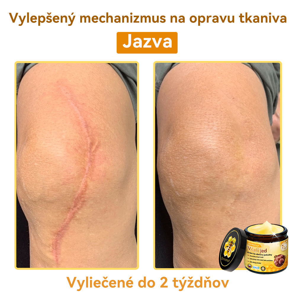 [💯 Bez bolesti-bez vedľajších účinkov] 𝐃𝐨𝐫𝐦𝐨𝐫𝐧𝐚®💥💥𝐕č𝐞𝐥í 𝐣𝐞𝐝 𝐊𝐫é𝐦 𝐧𝐚 𝐨𝐛𝐧𝐨𝐯𝐮 𝐩𝐨𝐤𝐨ž𝐤𝐲- POSLEDNÝ DEŇ 70% VYPNUTIE