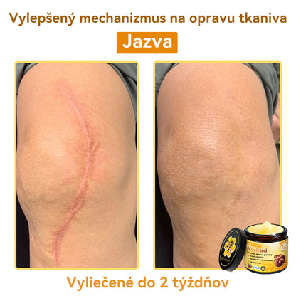 [💯 Bez bolesti-bez vedľajších účinkov] 𝐃𝐨𝐫𝐦𝐨𝐫𝐧𝐚®💥💥𝐕č𝐞𝐥í 𝐣𝐞𝐝 𝐊𝐫é𝐦 𝐧𝐚 𝐨𝐛𝐧𝐨𝐯𝐮 𝐩𝐨𝐤𝐨ž𝐤𝐲- POSLEDNÝ DEŇ 70% VYPNUTIE