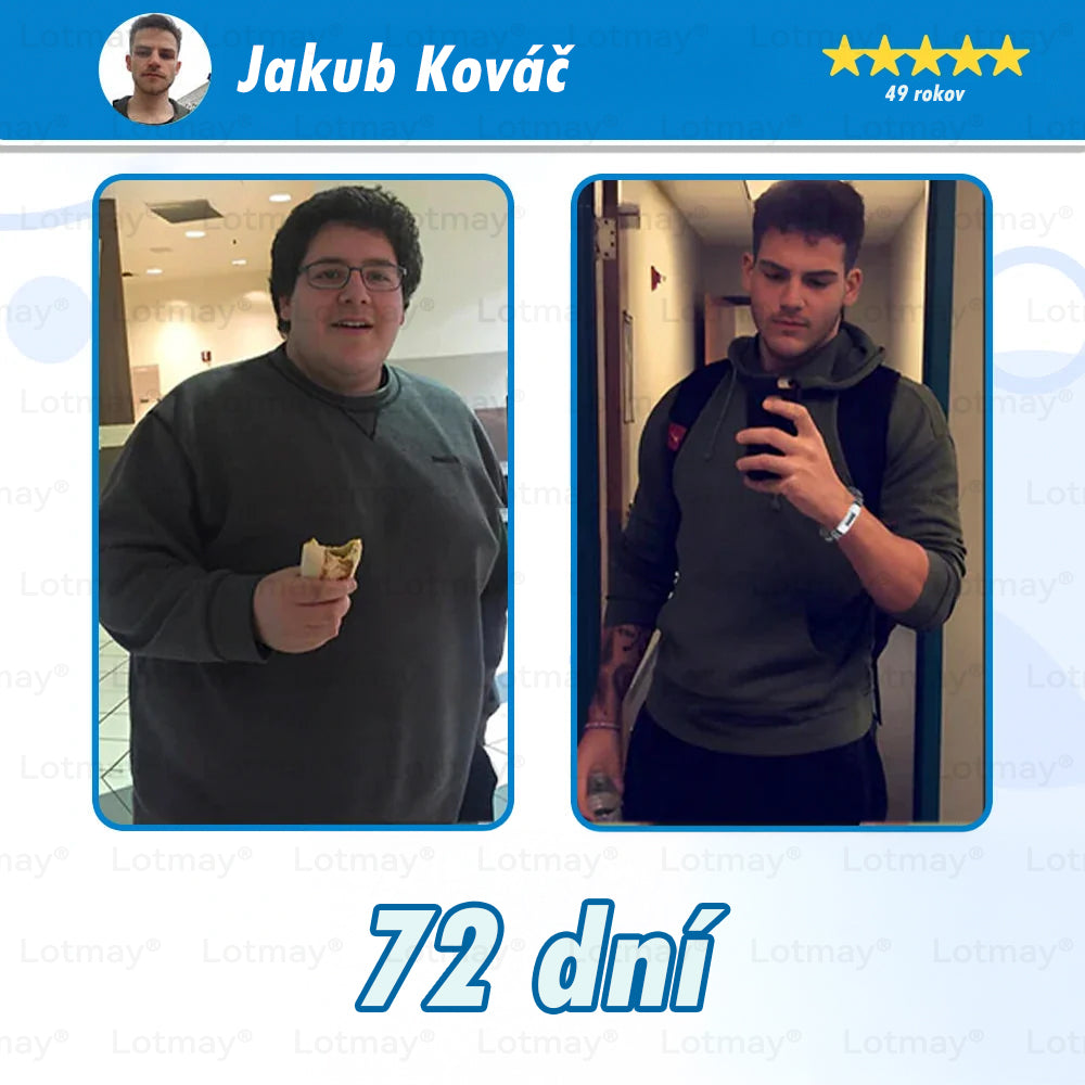 [⚡Oficiálny autorizovaný obchod] 𝐿𝑜𝑡𝑚𝑎𝑦® 🔥🔥 𝐺𝐿𝑃-1 𝐶ℎ𝑢𝑑𝑛𝑢𝑡𝑖𝑒 & 𝑧𝑑𝑟𝑎𝑣𝑖𝑒 𝑈𝑙𝑡𝑟𝑎 𝑘𝑜𝑛𝑐𝑒𝑛𝑡𝑟𝑜𝑣𝑎𝑛é 𝑒𝑠𝑒𝑛𝑐𝑖á𝑙𝑛𝑒 𝑘𝑎𝑝𝑠𝑢𝑙𝑦- NAD+ Moringa a jablčný ocot (✅rýchly, dlhotrvajúci, riešenie cukrovky, obezity a kardiovaskulárnych ochorení)