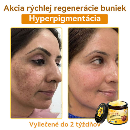 [💯 Bez bolesti-bez vedľajších účinkov] 𝐃𝐨𝐫𝐦𝐨𝐫𝐧𝐚®💥💥𝐕č𝐞𝐥í 𝐣𝐞𝐝 𝐊𝐫é𝐦 𝐧𝐚 𝐨𝐛𝐧𝐨𝐯𝐮 𝐩𝐨𝐤𝐨ž𝐤𝐲- POSLEDNÝ DEŇ 70% VYPNUTIE