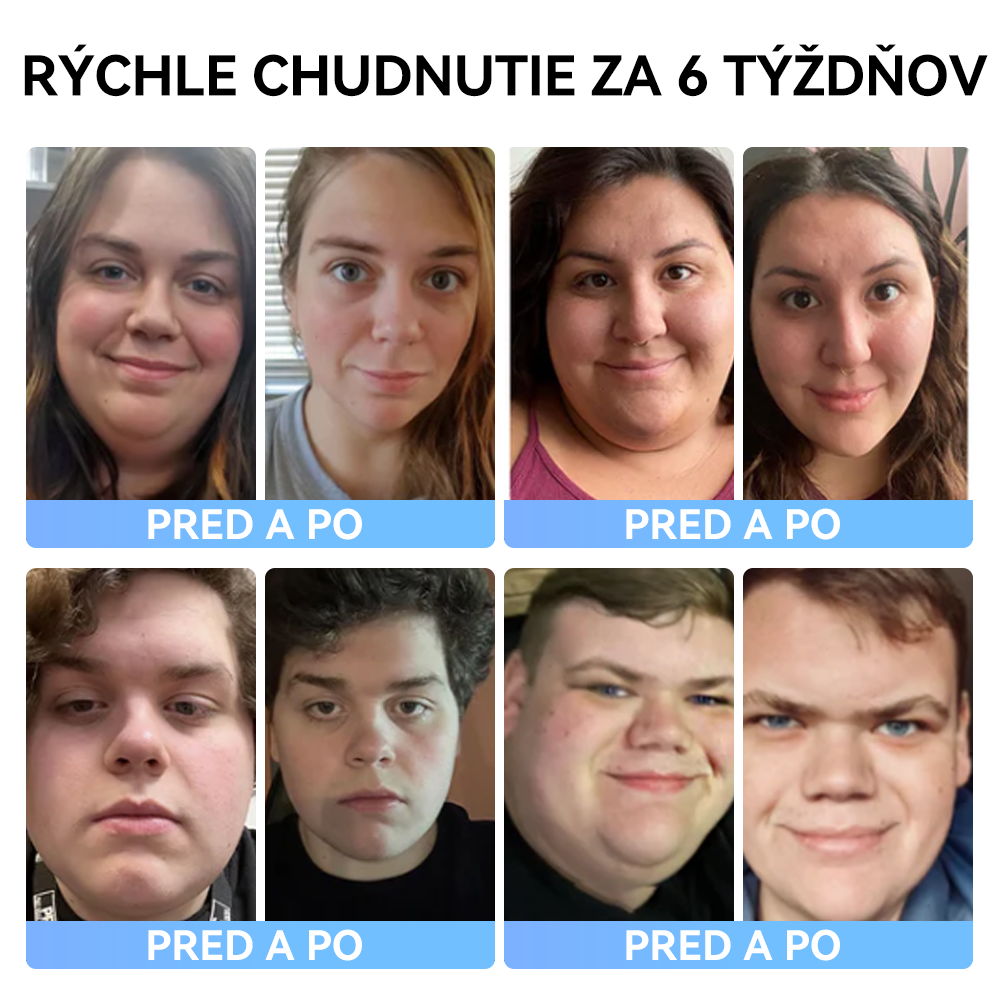 (✅Oficiálny obchod) 𝑺𝐩𝐳𝐯® 𝐌𝐞𝐠𝐥𝐮𝐭𝐢𝐝 ústna tekutina 💧 (Potravinársky produkt na spaľovanie tukov vyvinutý Akadémiou Komenského)