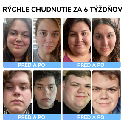 (✅Oficiálny obchod) 𝑺𝐩𝐳𝐯® 𝐌𝐞𝐠𝐥𝐮𝐭𝐢𝐝 ústna tekutina 💧 (Potravinársky produkt na spaľovanie tukov vyvinutý Akadémiou Komenského)