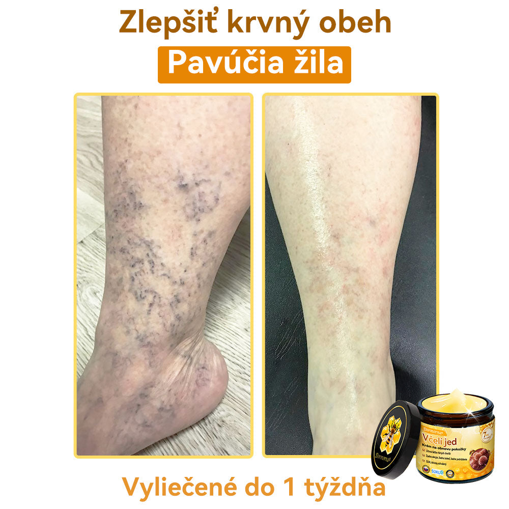 [💯 Bez bolesti-bez vedľajších účinkov] 𝐃𝐨𝐫𝐦𝐨𝐫𝐧𝐚®💥💥𝐕č𝐞𝐥í 𝐣𝐞𝐝 𝐊𝐫é𝐦 𝐧𝐚 𝐨𝐛𝐧𝐨𝐯𝐮 𝐩𝐨𝐤𝐨ž𝐤𝐲- POSLEDNÝ DEŇ 70% VYPNUTIE