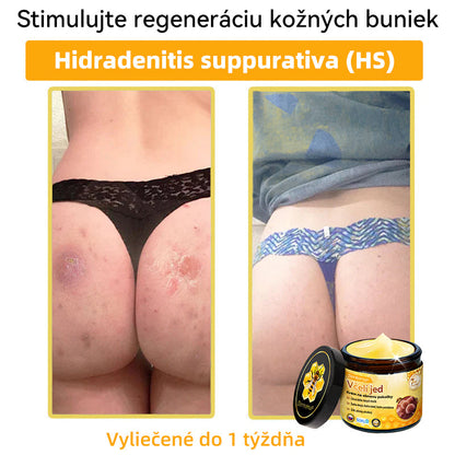 [💯 Bez bolesti-bez vedľajších účinkov] 𝐃𝐨𝐫𝐦𝐨𝐫𝐧𝐚®💥💥𝐕č𝐞𝐥í 𝐣𝐞𝐝 𝐊𝐫é𝐦 𝐧𝐚 𝐨𝐛𝐧𝐨𝐯𝐮 𝐩𝐨𝐤𝐨ž𝐤𝐲- POSLEDNÝ DEŇ 70% VYPNUTIE