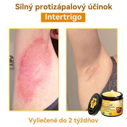 [💯 Bez bolesti-bez vedľajších účinkov] 𝐃𝐨𝐫𝐦𝐨𝐫𝐧𝐚®💥💥𝐕č𝐞𝐥í 𝐣𝐞𝐝 𝐊𝐫é𝐦 𝐧𝐚 𝐨𝐛𝐧𝐨𝐯𝐮 𝐩𝐨𝐤𝐨ž𝐤𝐲- POSLEDNÝ DEŇ 70% VYPNUTIE