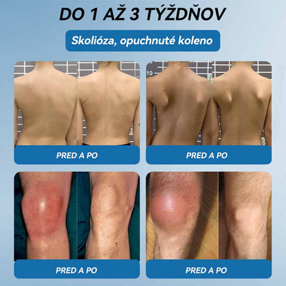 𝐎𝐟𝐢𝐜𝐢á𝐥𝐧𝐲 𝐨𝐛𝐜𝐡𝐨𝐝 | 👩‍⚕️🎁𝗣𝗶𝗰𝗱𝗼® 𝗕𝗣𝗖-𝟭𝟱𝟳 𝗞𝗿é𝗺 𝗻𝗮 𝗵𝗼𝗷𝗲𝗻𝗶𝗲 𝗸ĺ𝗯𝗼𝘃🦴Lieči artritídu, neuropatiu, reumu, športové zranenia a ďalšie ochorenia.👩‍⚕️