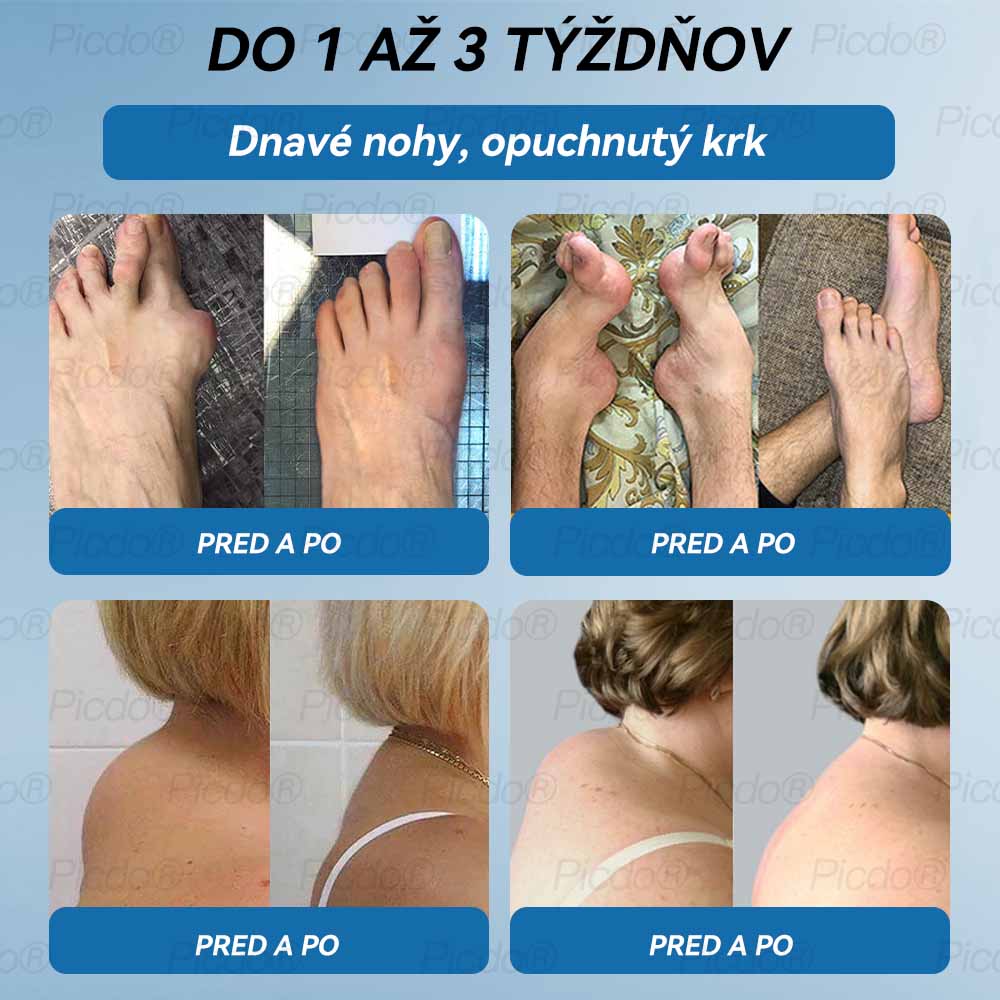 𝐎𝐟𝐢𝐜𝐢á𝐥𝐧𝐲 𝐨𝐛𝐜𝐡𝐨𝐝 | 👩‍⚕️🎁𝗣𝗶𝗰𝗱𝗼® 𝗕𝗣𝗖-𝟭𝟱𝟳 𝗞𝗿é𝗺 𝗻𝗮 𝗵𝗼𝗷𝗲𝗻𝗶𝗲 𝗸ĺ𝗯𝗼𝘃🦴Lieči artritídu, neuropatiu, reumu, športové zranenia a ďalšie ochorenia.👩‍⚕️