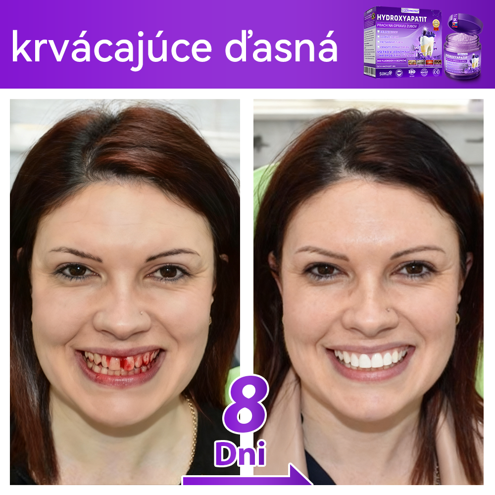 Oficiálny obchod 🔥|𝐷𝑜𝑟𝑚𝑜𝑟𝑛𝑎® 𝐻𝑦𝑑𝑟𝑜𝑥𝑦𝑎𝑝𝑎𝑡𝑖𝑡 𝑃𝑟𝑎𝑐ℎ 𝑛𝑎 𝑜𝑝𝑟𝑎𝑣𝑢 𝑧𝑢𝑏𝑜𝑣