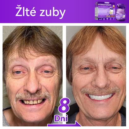 Oficiálny obchod 🔥|𝐷𝑜𝑟𝑚𝑜𝑟𝑛𝑎® 𝐻𝑦𝑑𝑟𝑜𝑥𝑦𝑎𝑝𝑎𝑡𝑖𝑡 𝑃𝑟𝑎𝑐ℎ 𝑛𝑎 𝑜𝑝𝑟𝑎𝑣𝑢 𝑧𝑢𝑏𝑜𝑣