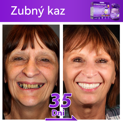 Oficiálny obchod 🔥|𝐷𝑜𝑟𝑚𝑜𝑟𝑛𝑎® 𝐻𝑦𝑑𝑟𝑜𝑥𝑦𝑎𝑝𝑎𝑡𝑖𝑡 𝑃𝑟𝑎𝑐ℎ 𝑛𝑎 𝑜𝑝𝑟𝑎𝑣𝑢 𝑧𝑢𝑏𝑜𝑣