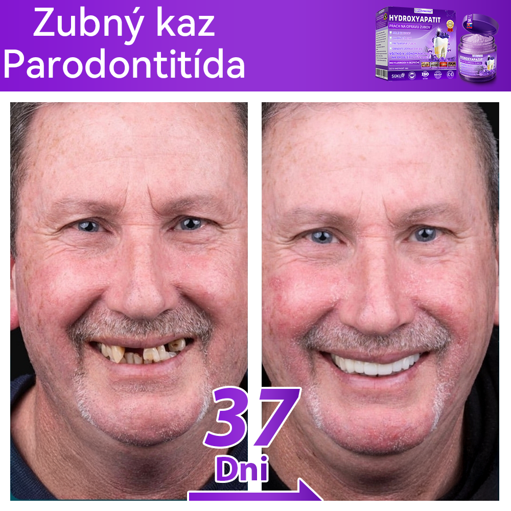 Oficiálny obchod 🔥|𝐷𝑜𝑟𝑚𝑜𝑟𝑛𝑎® 𝐻𝑦𝑑𝑟𝑜𝑥𝑦𝑎𝑝𝑎𝑡𝑖𝑡 𝑃𝑟𝑎𝑐ℎ 𝑛𝑎 𝑜𝑝𝑟𝑎𝑣𝑢 𝑧𝑢𝑏𝑜𝑣