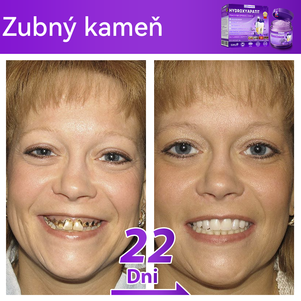 Oficiálny obchod 🔥|𝐷𝑜𝑟𝑚𝑜𝑟𝑛𝑎® 𝐻𝑦𝑑𝑟𝑜𝑥𝑦𝑎𝑝𝑎𝑡𝑖𝑡 𝑃𝑟𝑎𝑐ℎ 𝑛𝑎 𝑜𝑝𝑟𝑎𝑣𝑢 𝑧𝑢𝑏𝑜𝑣