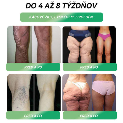 ✅ Odporúča viac ako 100 000 ľudí | Oficiálny obchod | 𝐒𝐓𝐃𝐄𝐈® 👨‍👧‍👧👨‍👧‍👧 𝐆𝐋𝐏-𝟏  𝐜𝐡𝐮𝐝𝐧𝐮𝐭𝐢𝐞 𝐩𝐞𝐫𝐨𝐫á𝐥𝐧𝐲 𝐫𝐨𝐳𝐭𝐨𝐤 - Obezita, kardiovaskulárne ochorenia, cukrovka, spánkové dýchanie, problémy s kĺbmi a ďalšie