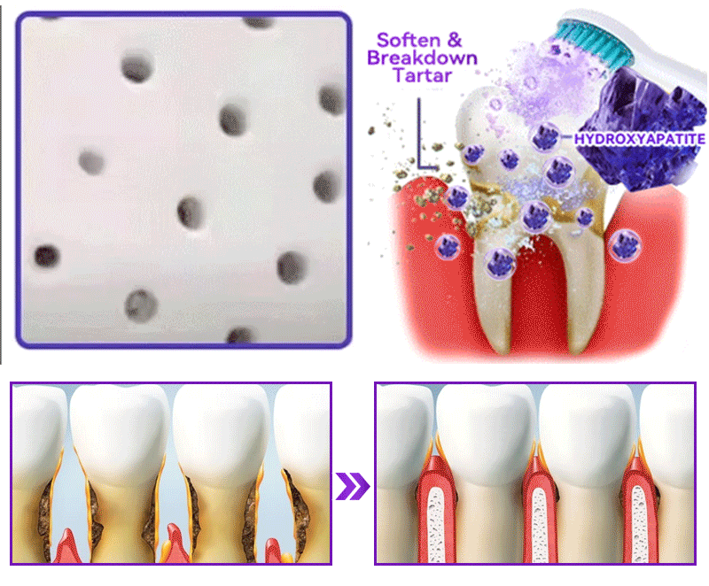Oficiálny obchod 🔥|𝐷𝑜𝑟𝑚𝑜𝑟𝑛𝑎® 𝐻𝑦𝑑𝑟𝑜𝑥𝑦𝑎𝑝𝑎𝑡𝑖𝑡 𝑃𝑟𝑎𝑐ℎ 𝑛𝑎 𝑜𝑝𝑟𝑎𝑣𝑢 𝑧𝑢𝑏𝑜𝑣